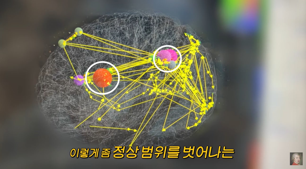 방송인 홍진경, 미국서 뇌 검사 후 우울감 및 기억력 저하 치료