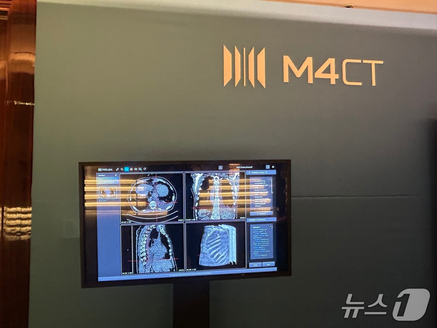 딥노이드 생성형 AI 의료기기 'M4CXR'. ⓒ 뉴스1 문대현 기자